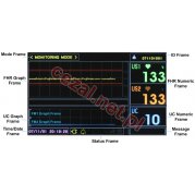 Kardiotokograf KTG Bistos BT-350 LCD (ID3390)