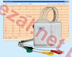 CardioTEL Alfa System NET v.001 (ID430) - Kliknij na obrazek aby go zamknąć