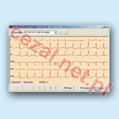 CardioTEKA - oprogramowanie v.001 (ID407) - Kliknij na obrazek aby go zamknąć