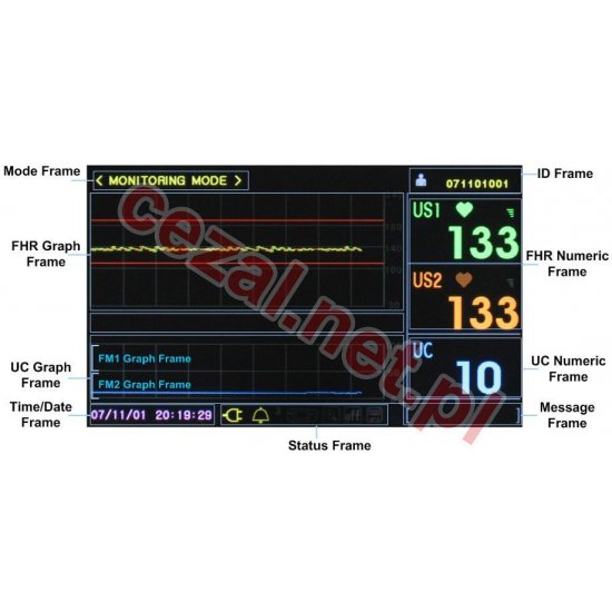 Kardiotokograf KTG Bistos BT-350 LCD (ID3390) - Kliknij na obrazek aby go zamknąć