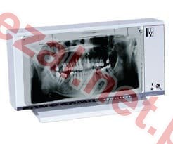 Negatoskop dentystyczny PANORAM 01 serii NGP (ID3505) - Kliknij na obrazek aby go zamknąć